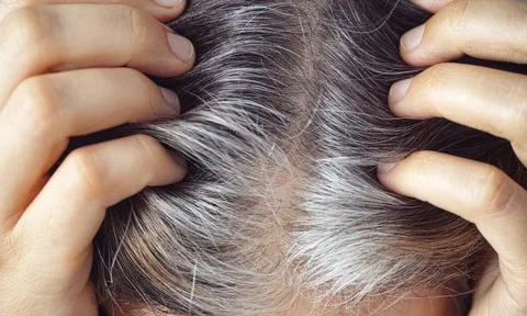 Tóc bạc sớm và rụng nhiều trước tuổi 40: Nhiều phụ nữ bắt đầu chú ý hơn đến top thực phẩm này