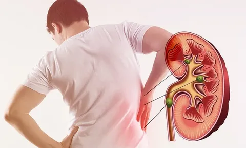 4 dấu hiệu cảnh báo thận của bạn đang kêu cứu