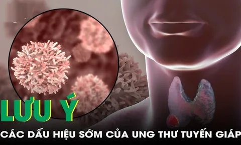 5 dấu hiệu K tuyến giáp mới chớp: Biết sớm chữa là khỏi
