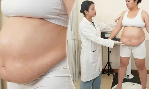 Giảm béo chuẩn y khoa: Khi kiểm soát cân nặng trở thành bài toán sức khỏe của xã hội hiện đại