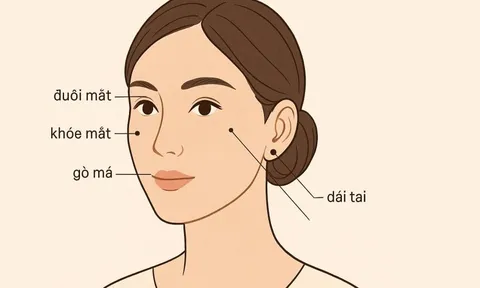 3 nốt ruồi trên mặt mang tới may mắn cho bạn: Cả đời bình an
