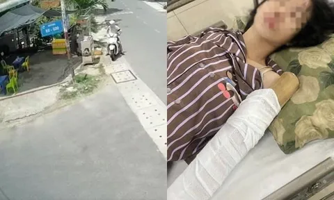 Vụ cô gái bị cuốn tay vào máy ép nước mía: Chồng bất ngờ xin dừng nhận hỗ trợ từ cộng đồng