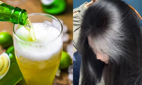 Cách gội đầu bằng bia giúp sạch gàu, mượt tóc, tóc con mọc ầm ầm