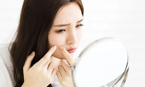 5 cách chăm da giúp làm mờ thâm lâu năm và hỗ trợ da đều màu hơn tại nhà