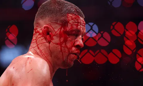 Nate Diaz lên tiếng sau thất bại đẫm máu trước Mike Perry: 'Giờ là lúc bắt đầu cuộc đi săn'
