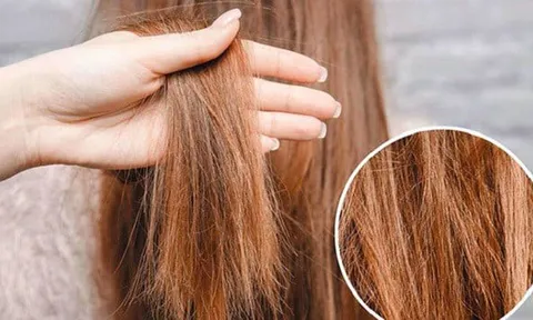 5 cách phục hồi tóc cháy nắng giúp tóc mềm hơn, giảm khô xơ trong mùa hè