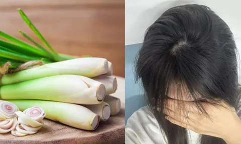 Cách gội đầu bằng sả giúp sạch gàu, tóc lâu bết, tóc con đua nhau mọc