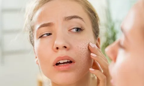 Dưỡng ẩm quá mức có thể khiến da “quá tải”