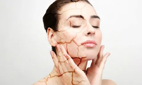 Nắng nóng đỉnh điểm khiến da dễ cháy nắng: Cách bảo vệ và phục hồi da đúng cách