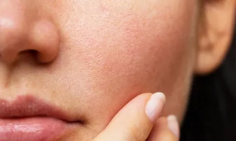 Ngồi điều hòa nhiều khiến da khô ráp? Thử ngay phương pháp dưỡng da “nhiều lớp” để giữ da căng mịn