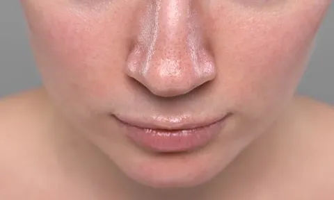 3 sai lầm chăm da mùa hè khiến da dễ đổ dầu, nổi mụn và nhanh lão hóa