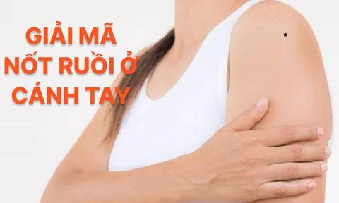 4 nốt ruồi trên cánh tay mang tới may mắn cho bạn: Đừng dại xóa đi