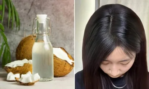 Cách giảm rụng tóc, kích thích tóc mọc dày, hiệu quả nhờ dầu dừa