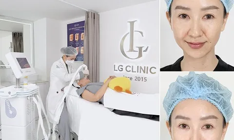 Nguyên nhân nhiều hoa hậu lựa chọn LG Clinic để xóa rãnh cười, thon gọn khuôn mặt