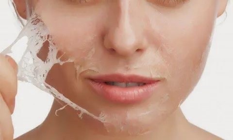 7 dấu hiệu cảnh báo làn da đang mất dần collagen, nhiều người gặp phải nhưng dễ bỏ qua