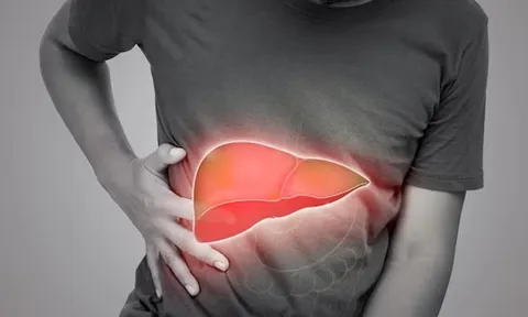 5 dấu hiệu cảnh báo bệnh gan của bạn đã đi vào giai đoạn nặng