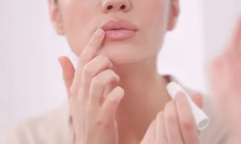 Môi khô, nứt nẻ kéo dài: Cách chăm sóc giúp đôi môi luôn mềm mại