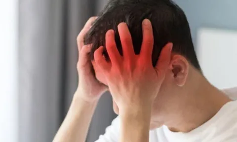 Tưởng đau đầu do nắng nóng, nam nhân viên văn phòng bất ngờ khi bác sĩ thông báo bị xuất huyết não