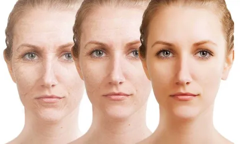 5 thói quen hằng ngày khiến collagen suy giảm nhanh, làn da dễ lão hóa sớm