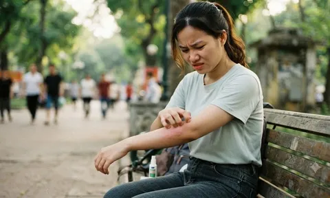 4 kiểu ngứa "tín hiệu báo động" bệnh nguy hiểm: Đừng chủ quan kẻo bỏ lỡ thời điểm vàng!