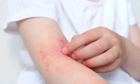 Quan sát bằng mắt thường thấy có dấu hiệu này chứng tỏ thận đang gặp vấn đề, có thể đang bị tổn thương