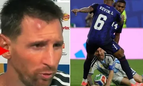 Lionel Messi và vết sưng trên trán sau trận thắng Cape Verde
