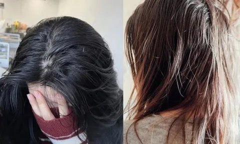 6 thói quen khiến tóc nhanh bết mà nhiều người vẫn lặp lại mỗi ngày