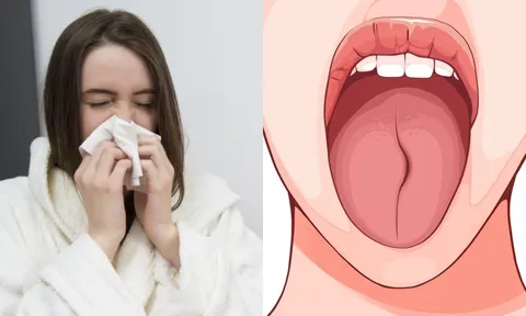 Lưỡi có 3 dấu hiệu này: Nên đi khám càng sớm càng tốt