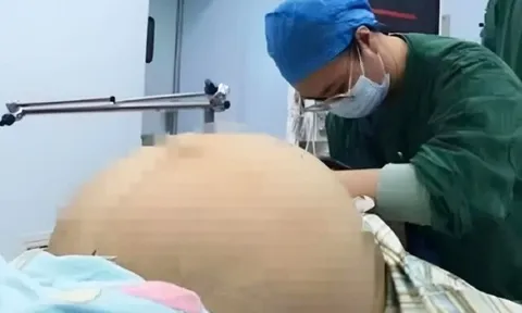 Thiếu nữ 2K2 bụng phình to như có bầu, mẹ lo lắng đưa đi khám, kết quả chụp CT tại bệnh viện gây ngỡ ngàng