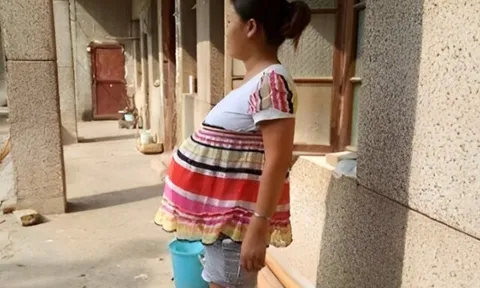 Cơ thể bất ngờ mọc thêm “vật thể lạ” khi mang thai, người mẹ bối rối không dám mặc đồ hở