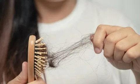 Muốn giảm tóc rụng khi gội đầu? Đừng bỏ qua bước đơn giản này trước khi làm ướt tóc
