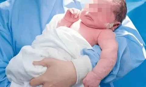 Mẹ bầu mê ăn sầu riêng suốt thai kỳ, ngoại hình em bé khi chào đời khiến cả phòng sinh bất ngờ