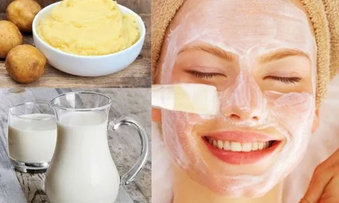 Những lợi ích có thể nhận được khi đắp mặt nạ khoai tây và sữa tươi