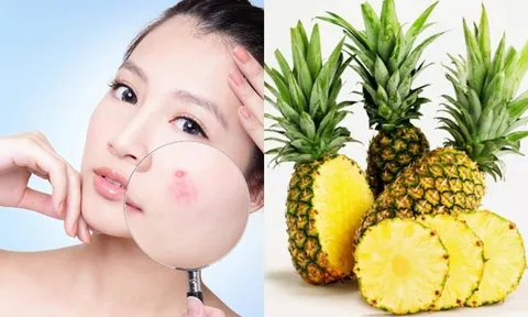 Dứa mang đến nhiều lợi ích cho làn da, từ dưỡng ẩm đến hỗ trợ chống lão hóa