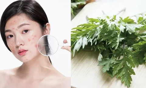Lá ngải cứu có giúp làm mờ nám?