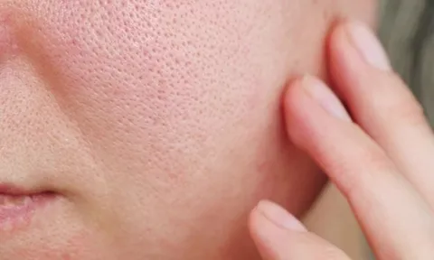 Lỗ chân lông trông nhỏ hơn nhờ quy trình chăm sóc da chỉ với 4 bước cơ bản