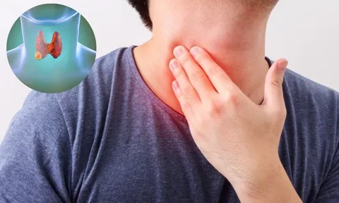 5 dấu hiệu u tuyến giáp đang âm thầm phát triển, nhiều người bỏ qua