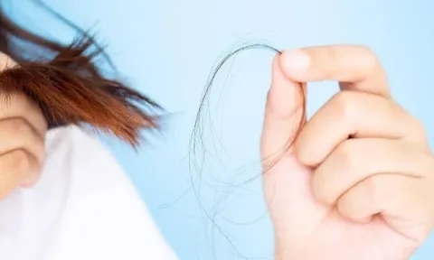 Mỗi sáng thức dậy tóc rụng đầy gối? 4 thói quen trước giờ ngủ có thể là nguyên nhân