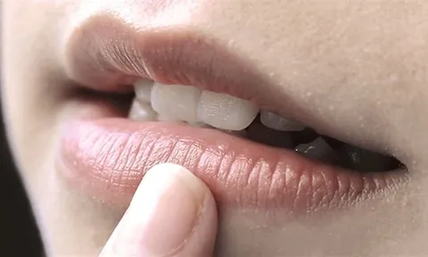 4 thói quen khiến môi ngày càng thâm sạm, nhiều người mắc phải mà không hay biết