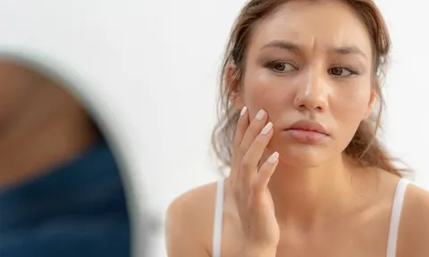 5 thói quen tưởng vô hại nhưng có thể khiến làn da khó bật tông