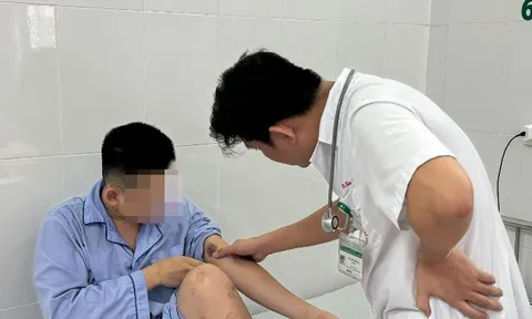 Người đàn ông kéo giun rồng ra từ cánh tay, chuyên gia cảnh báo điều quan trọng ai cũng cần ghi nhớ