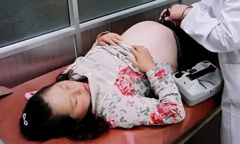 Bụng phình to cứ tưởng có bầu, cô gái trẻ được gia đình đưa đi khám, kết quả chụp CT gây ngỡ ngàng