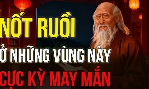 3 nốt ruồi Quý nhân phù trợ, đừng dại tẩy đi