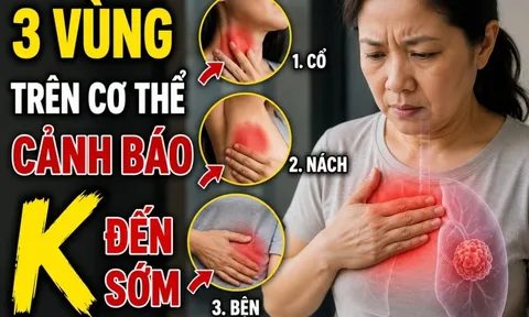 3 vùng trên cơ thể cảnh báo K đến sớm