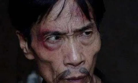 Tại sao người hai má không có thịt không nên kết giao?