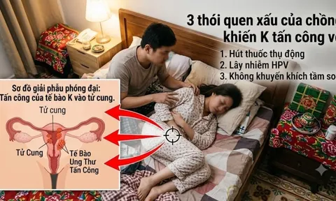 3 thói quen xấu của chồng khiến K tấn công vợ