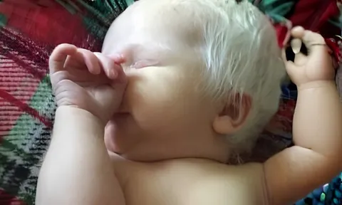 Bố mẹ đều tóc đen lại đẻ con tóc bạc trắng, chồng nghi vợ "cắm sừng", kết quả ADN phơi bày sự thật không ngờ