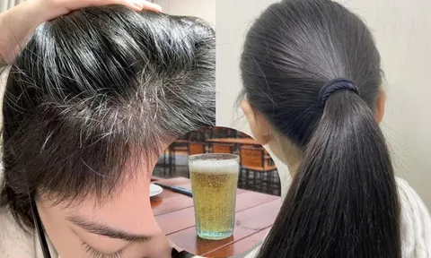 Cách gội đầu bằng bia giúp tóc dày mượt, tóc con nhanh mọc