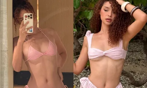 Cô gái 8 ngón tay từng bị trêu ghẹo vì mái tóc, body ngày càng "bốc lửa", thi Hoa hậu ẵm giải mặc bikini đẹp