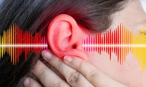 Thiết bị kích thích thần kinh tai mở hướng mới kiểm soát huyết áp